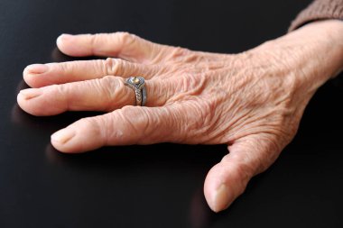 Covidien-19 virüsü ve yaşlı bir insan eli.,