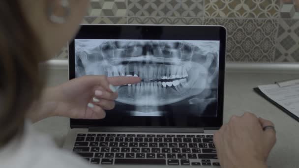 Два лікарі аналізують рентгенівське зображення зубів на ноутбуці — стокове відео
