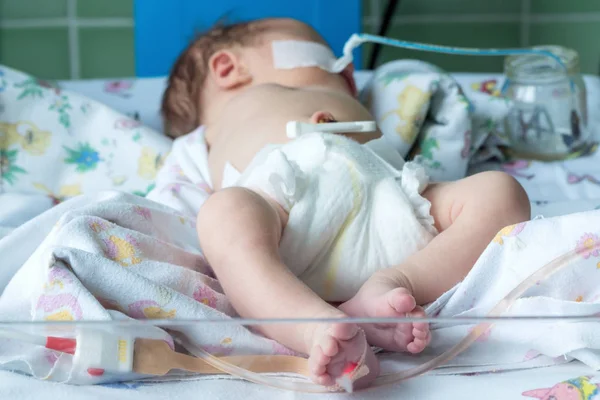 Bebê recém-nascido com tubo orogástrico e sensor de oxímetro de pulso — Fotografia de Stock