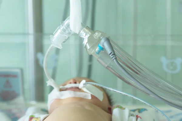 Bebê recém-nascido na máquina de respiração ou ventilador com tubo orogástrico — Fotografia de Stock