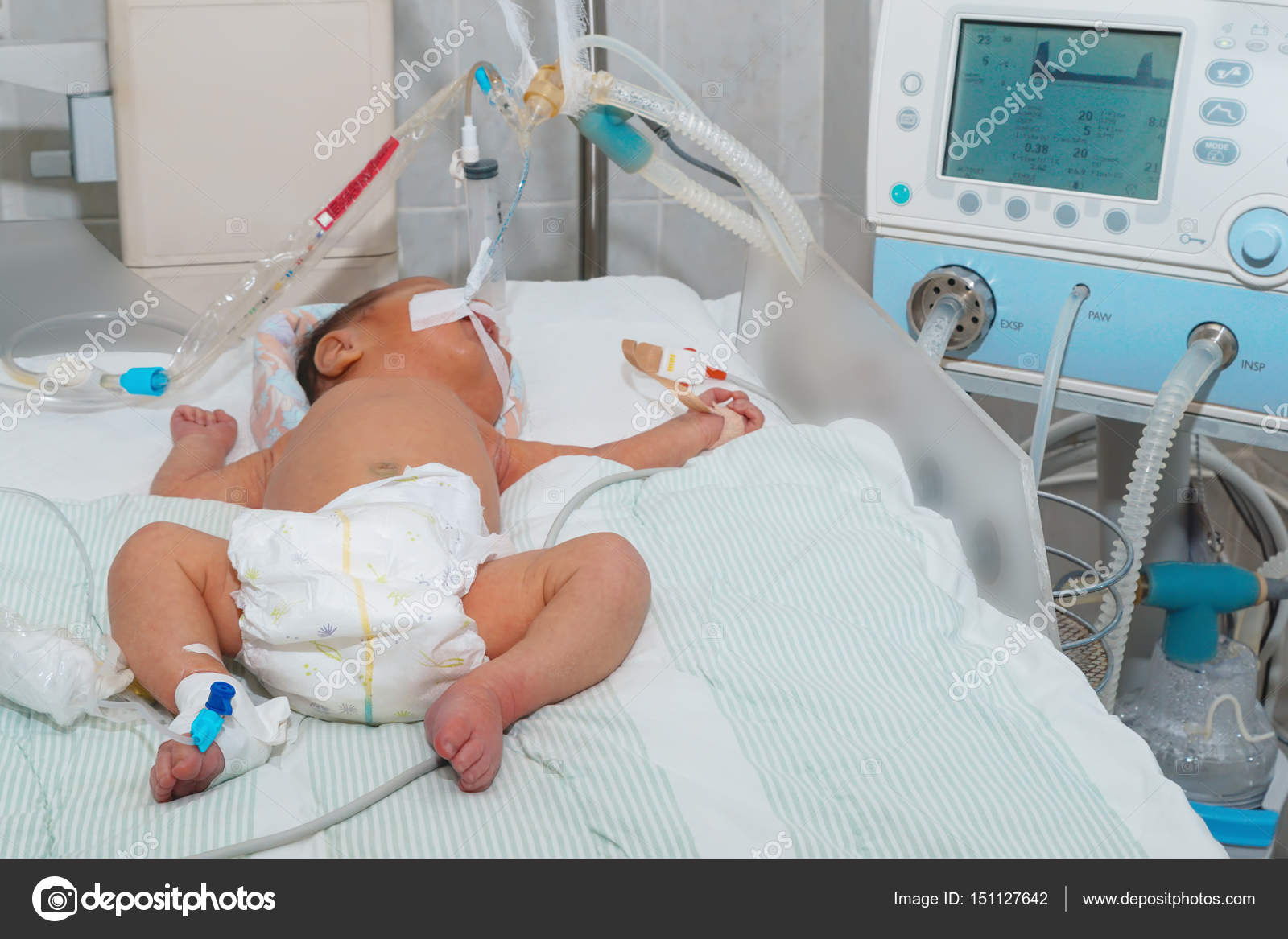 Ventilador bebes recien nacidos hotsell