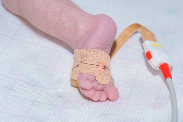 Датчик пульса оксиметра на ноге новорожденного ребенка в детской больнице
