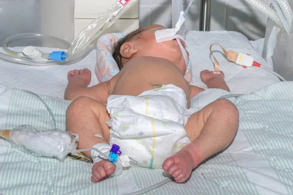 Neonato su respiratore con sensore di pulsossimetro e catetere endovenoso periferico all'ospedale pediatrico — Foto Stock