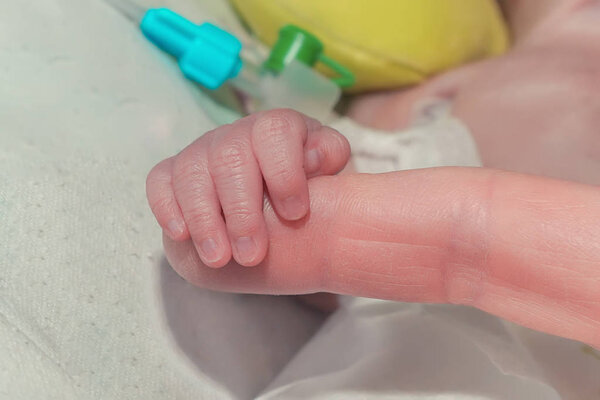 Рука недоношенного новорожденного ребенка с дренажем плевральной полости
