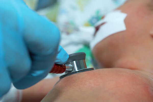 Врач держит стетоскоп в руке и делает аускультацию новорожденного ребенка на дыхательной машине
