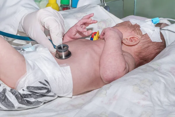 Peristalsi da medico auscultato del neonato con catetere endovenoso periferico nella vena della testa in unità di terapia intensiva neonatale — Foto Stock