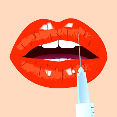 Dudaklar ve botox enjeksiyon. Kırmızı dudaklar. Güzellik kavramı, vektör çizim