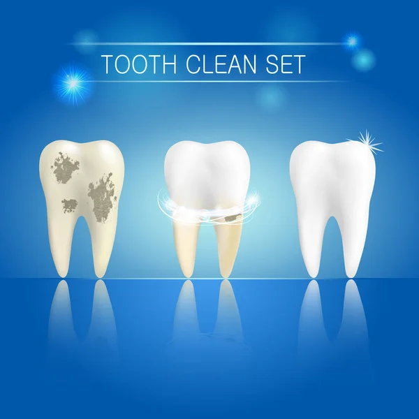 Sada čistých a nečistých zubu na modrém pozadí, čištění zubů procesu. Bělení zubů koncept. Vektorové ilustrace — Stockový vektor