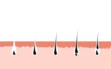 Saç uzama döngüsü derisi. Folikül anatomisi aşaması, saç büyüme diyagramı çizimi