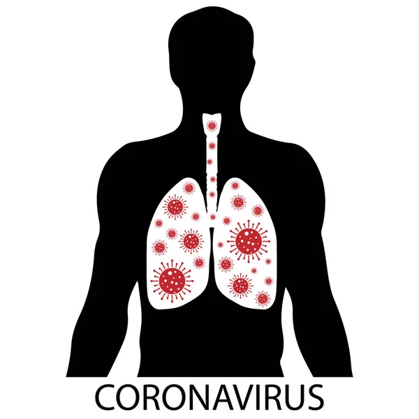 Quarantena virale. Sindrome respiratoria MERS-Cov Medio Oriente. Polmoni umani infettati dal virus. Sistema respiratorio. Malattia all'interno di una persona — Vettoriale Stock