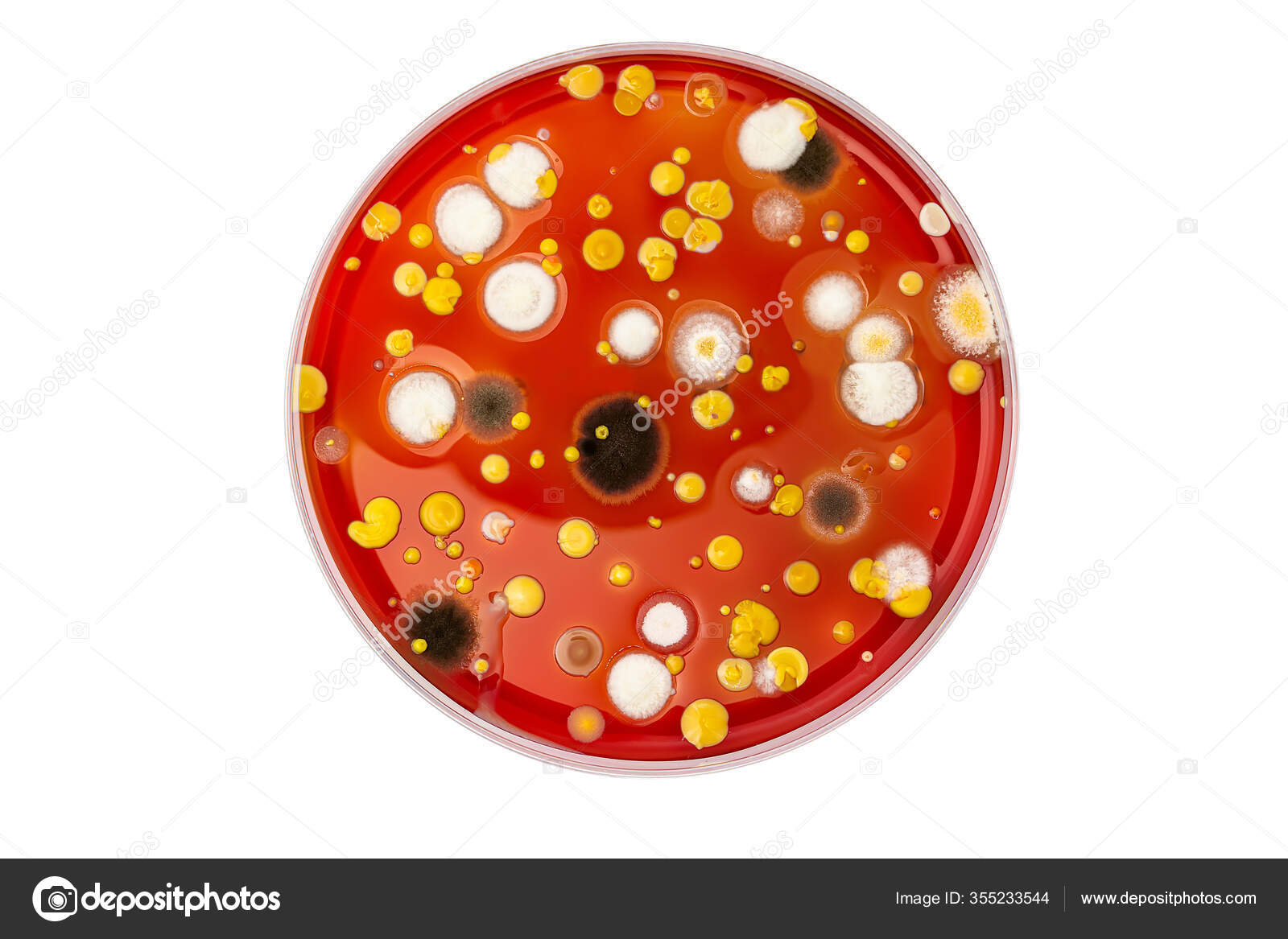 Petri Dish Bacteria Identification
