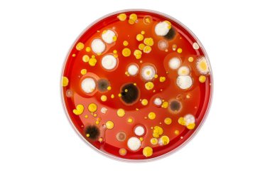 Petri dish with mixed of bacteria colonies clipart