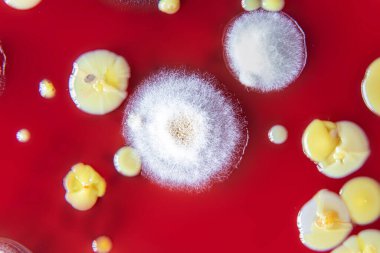 Petri kabında bakteri kolonilerinin karışımı.