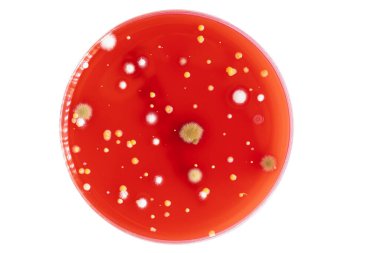 Petri dish with mixed of bacteria colonies clipart