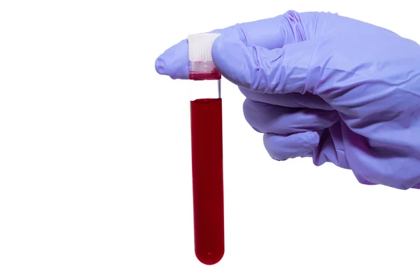 Hand Eines Labortechnikers Mit Einer Blutprobe — Stockfoto