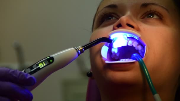Установка скобок на зубы, девушка в стоматологическом кабинете — стоковое видео