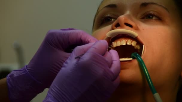 Il dentista controlla il morso del paziente con lo specchio dentale — Video Stock