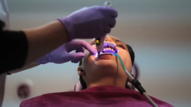 Instalación de los soportes en los dientes de una joven hembra — Vídeo de stock