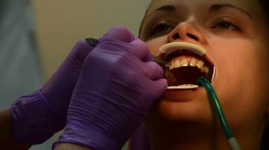 Diş telleri için diş bağlama