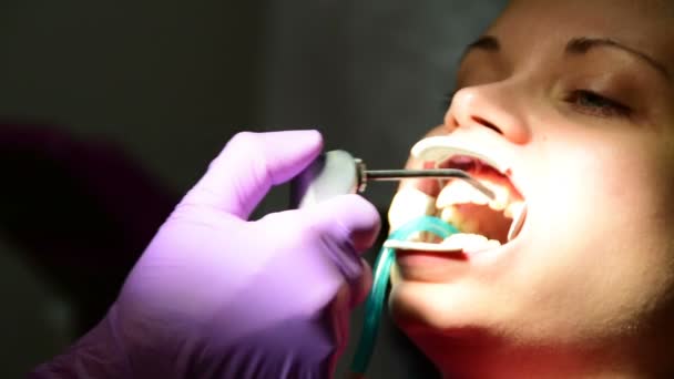 Rozpylanie i czyszczenia zębów przed oddaniem nawiasy klamrowe, młoda kobieta w gabinecie stomatologicznym — Wideo stockowe