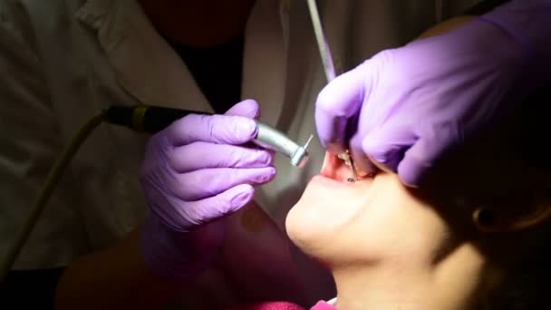 Una mujer joven quita la caries de los dientes al dentista — Vídeo de stock