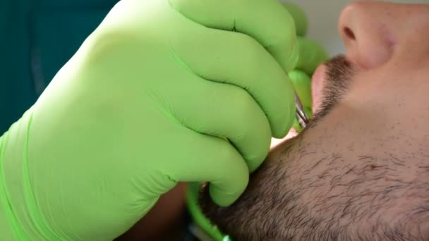 Close-ups, tandheelkundige handen in groene handschoenen, tot vaststelling van de tanden van een mannelijke patiënt — Stockvideo