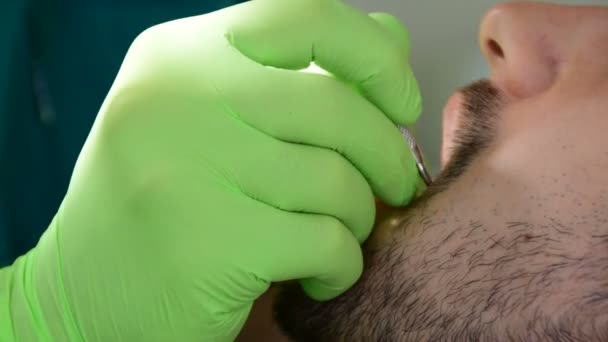Zbliżeń, stomatologiczne ręce w zielone rękawice, mocowania zębów pacjenta — Wideo stockowe