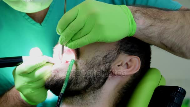 Genç bir adam, onun teeths, diş sandalyede oturan genç yakışıklı adam--dan kaldırma çürük ağız diş hekimleri elinde — Stok video