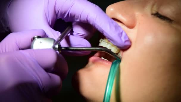 Dentista está colocando aparelho nos dentes de uma jovem — Vídeo de Stock