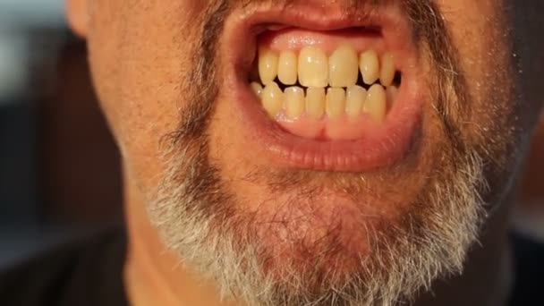 Open Mouth Men Gray Beard Who Screams Sings Front Camera — Stock Video