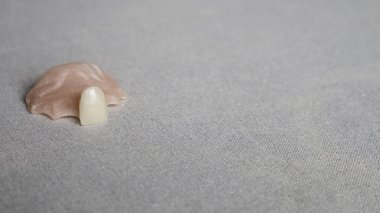 Bir takma diş. Arka planda diş protezleri var. Takma diş. Diş hekimliği. Protez dişler. Boşluk yok. Metin için alanı kopyala.