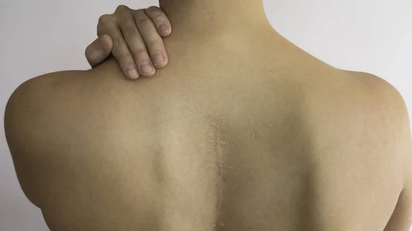 Espalda Desnuda Mujer Con Cicatriz Largo Columna Vertebral —  Fotos de Stock