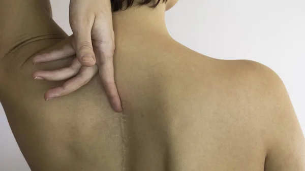 A woman's hand shows a scar on her back.