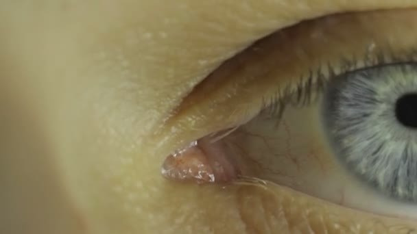 Œil du jeune homme, macro 