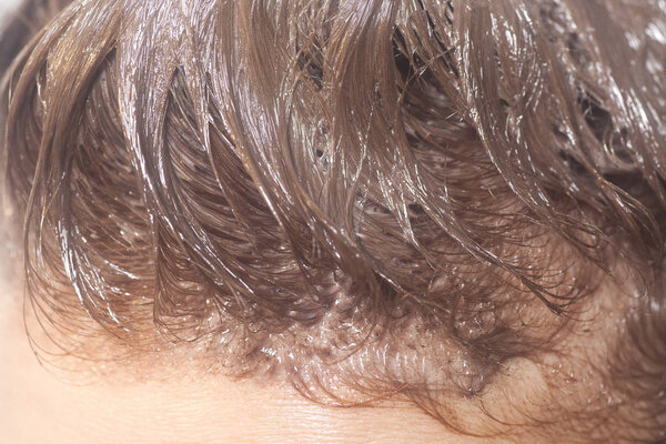 Woman hair colouring in process