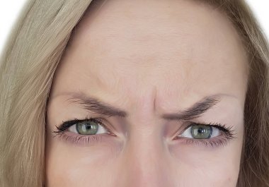 kadın frowns onu alın, kırışıklıklar, botox
