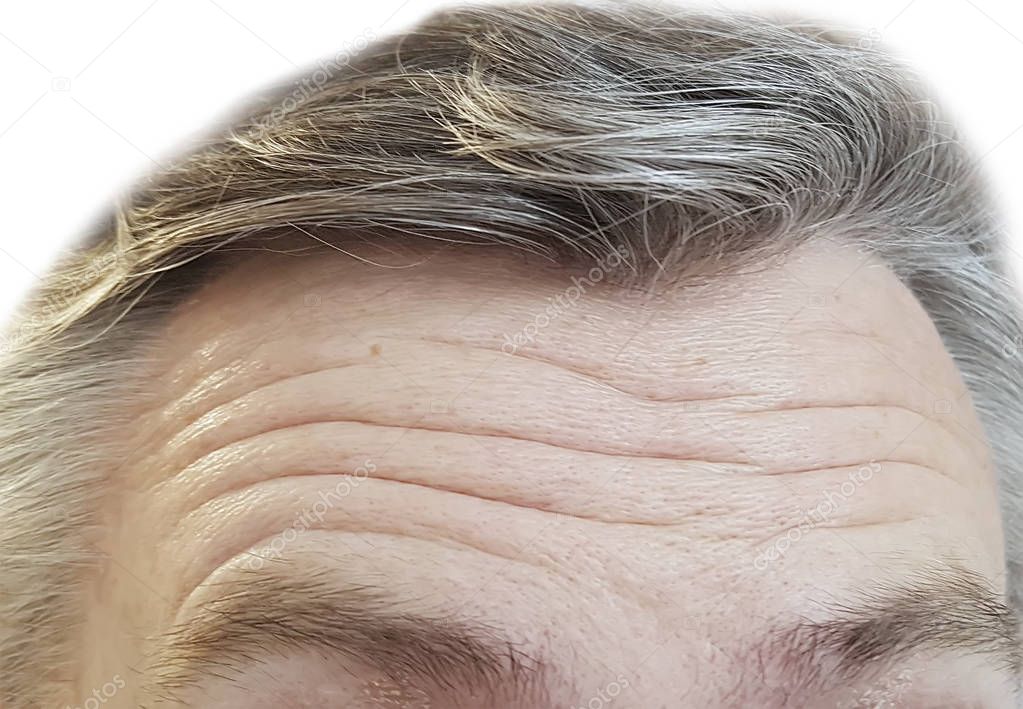 forehead men wrinkles, gray