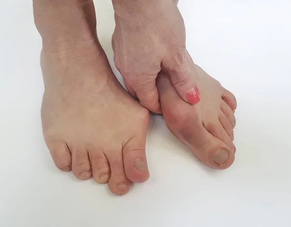 Beyaz bir arka plan üzerinde valgus kadın bacak