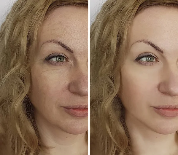 面部妇女皱纹前和后化妆程序 — 图库照片