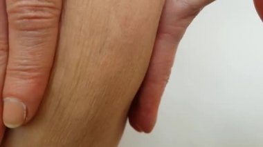 bacaklar bir kadın Selülit