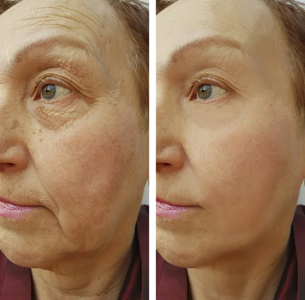 Face Woman Elderly Wrinkles Stock Image