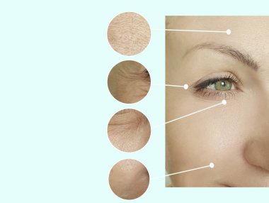 kadın kırışıklıkları yüz işlemden önce ve sonra