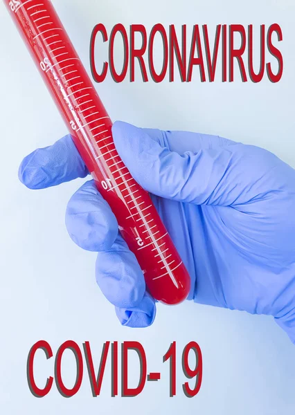 Hand Medical Glove Holds Test Tube Blood — Stock Photo, Image