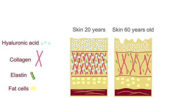 The anatomical structure of the skin. Elastin, hyaluronic acid, collagen. Skin aging, wrinkles before and after