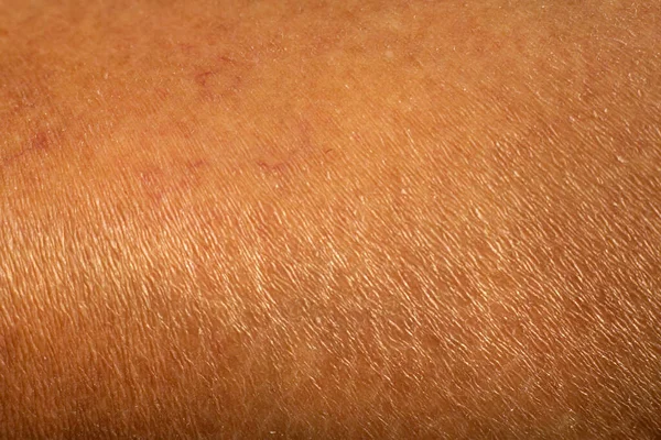 Woman Dry Skin Leg Close Macro Shot Asian Body Skin — Stock Photo, Image