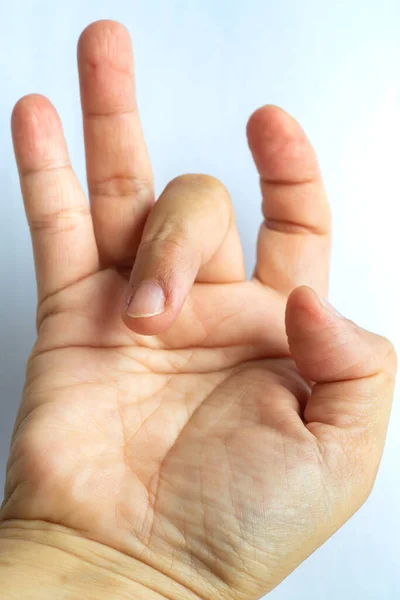 トリガー女性の右手の中指に指ロック 痛みに苦しんで 白の背景 ヘルスケアの概念 — ストック写真