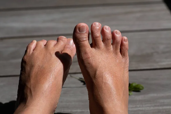 Women Second Toes Middle Toe Fourth Toe Crooked Wooden Background — Stock Photo, Image