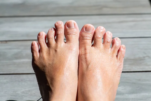 Women Second Toes Middle Toe Fourth Toe Crooked Wooden Background — Stock Photo, Image