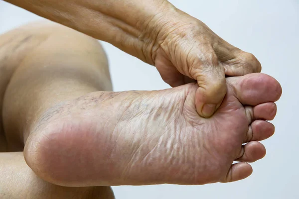 Senior Woman Suffering Left Foot Pain Massaging Her Hand White — Stock Photo, Image