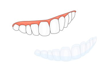 Diş telleri ya da beyaz arka planda izole edilmiş görünmez diş telleri. Güzel bir gülümsemeye sahip olmanın bir yolu. Diş hekimi, ortodontik tedavi konsepti. Diş telleri. Ortodonti. Stok vektörü 